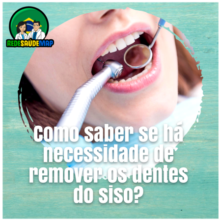 Como saber se há necessidade de remover os dentes do siso?